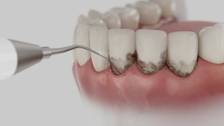 Reliable Tooth Extraction contractor in Morristown, TN by Smile Center Dentistry